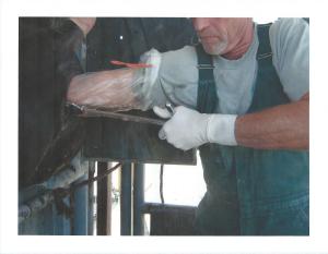 Invasive Sterilization